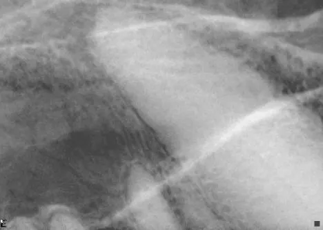 A radiographic image shows a close-up view of a canine thoracic cavity, highlighting the heart and surrounding structures. The image displays varying densities, indicating the presence of soft tissues and potential abnormalities within the chest area.