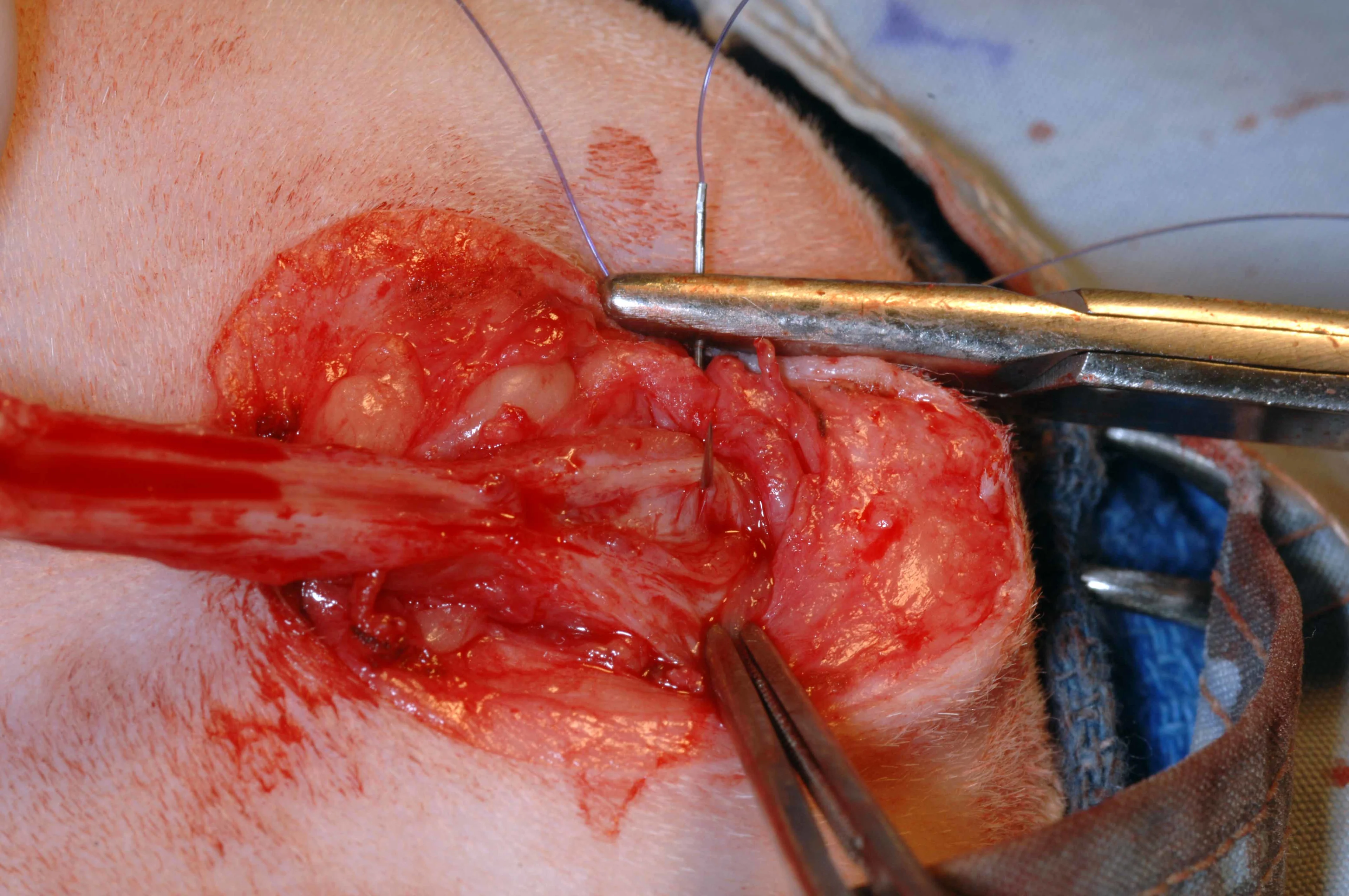 A: Intraoperative photo showing exposure of the urethral mucosa.  B: A surgeon is placing simple interrupted sutures between the skin and urethral mucosa.  C: Hemostats are used to separate the dorsal and ventral urethral mucosa during suturing