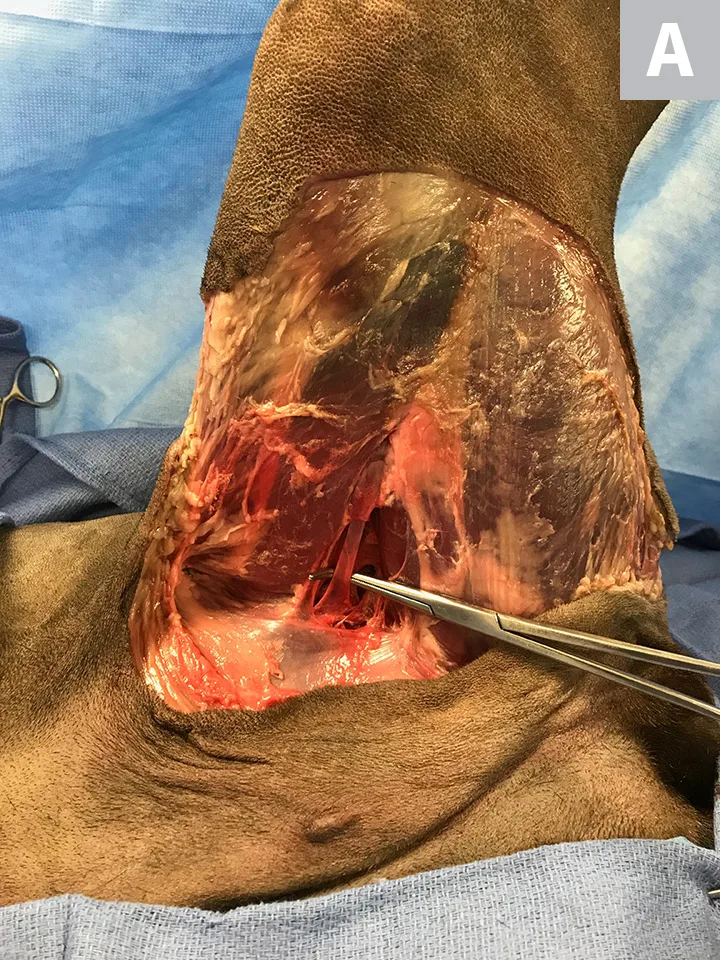 Two images showing femoral vein before and after ligation and where to cut between ligatures.