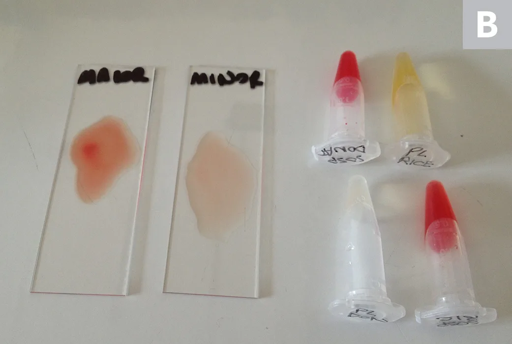 Figure A shows 2 units of whole blood. Figure B shows 2 slides and 4 tubes of RBC and plasma samples used for major and minor crossmatching. 