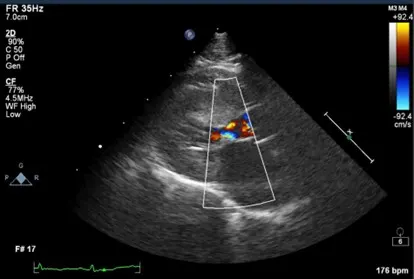 Color Doppler echocardiogram in a cat.