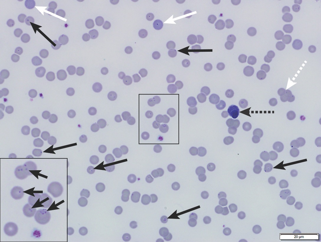 Clinical Image: Erythroparasite on a Feline Blood Smear