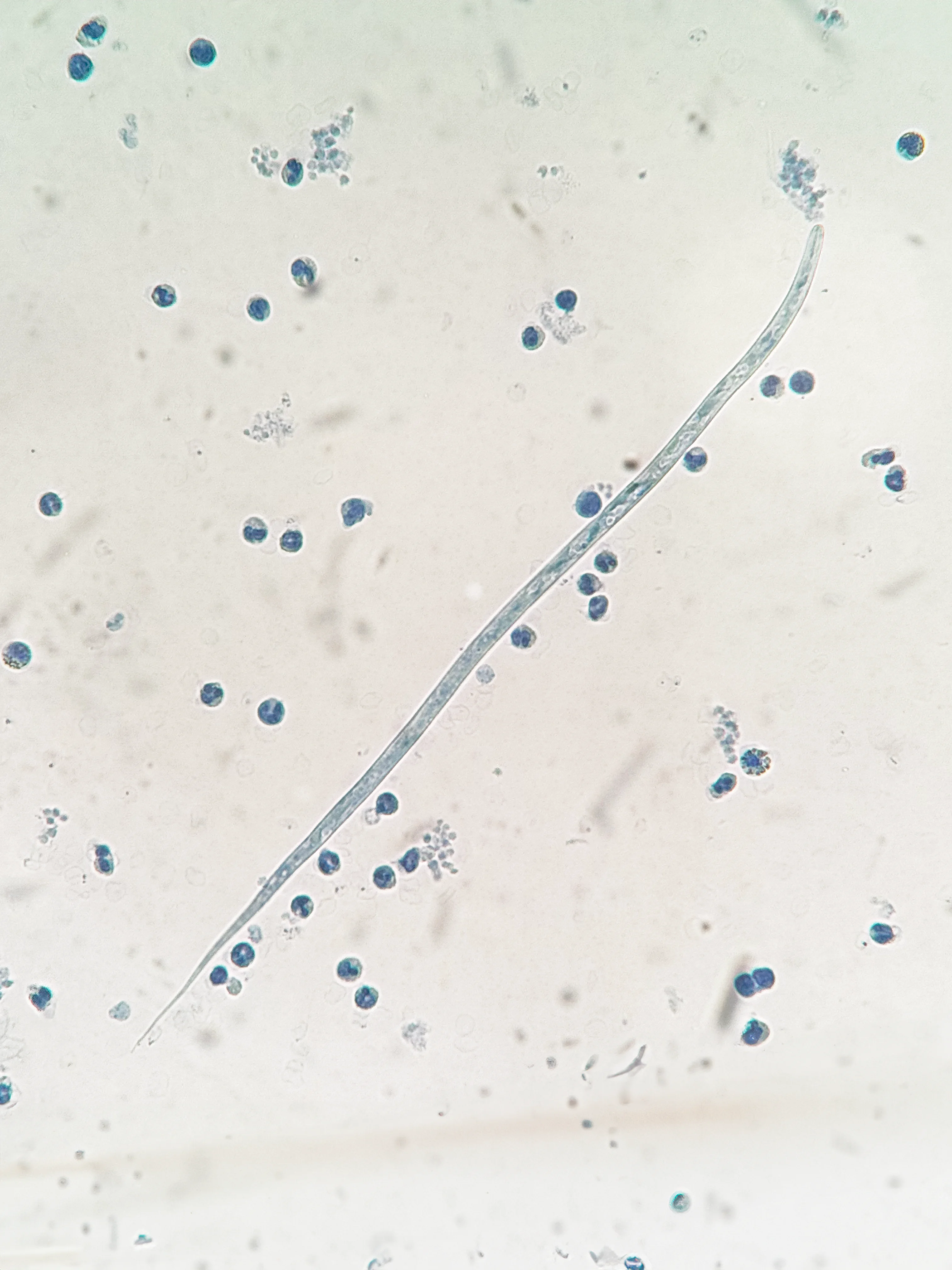 Parasite visible under a microscope.