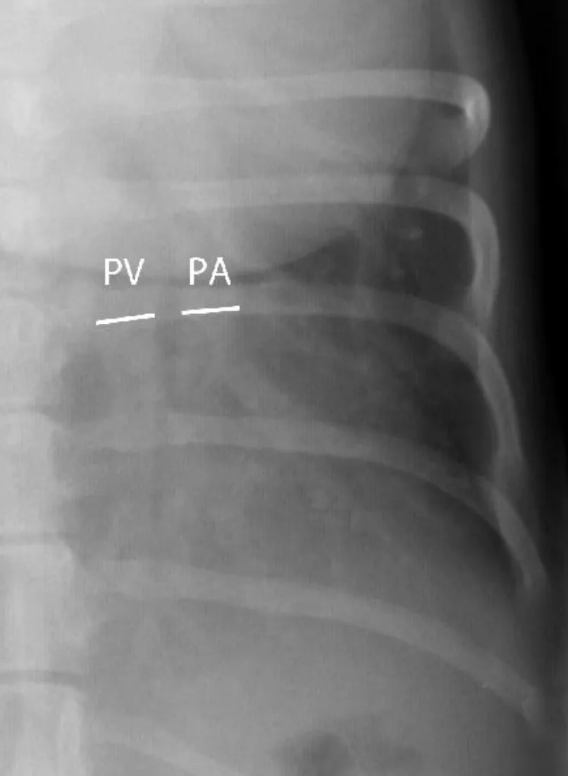 Lateral and VD thoracic X-rays of different dogs illustrating various patterns of pulmonary parenchymal opacity.