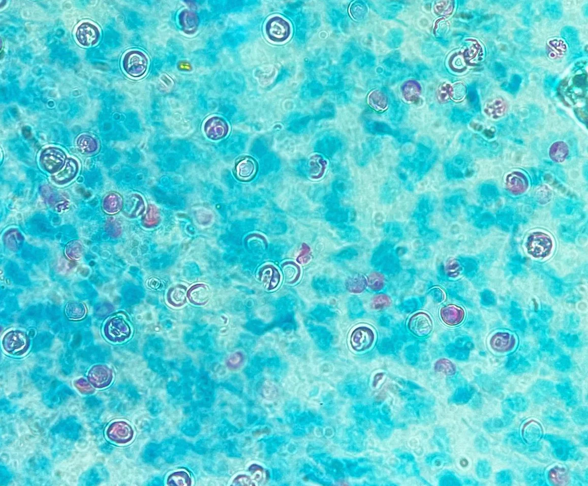 Slide showing oocysts.