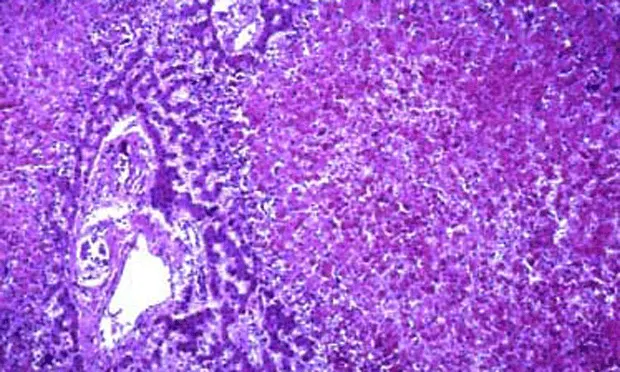 Stained histopathology slide of the liver.