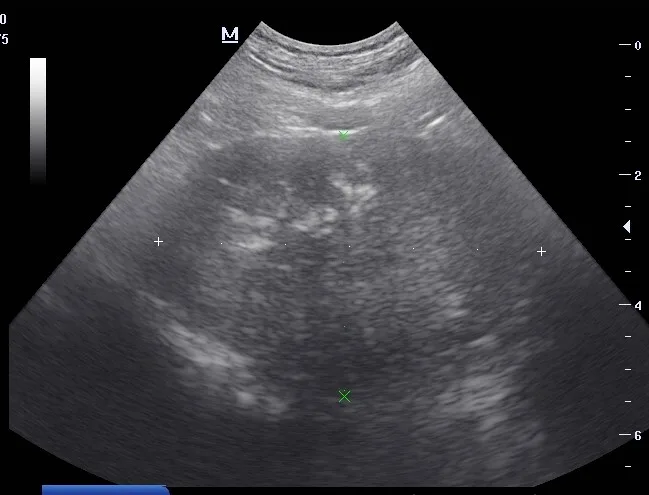 Two ultrasound images demonstrating heteroechogenic appearance of a dog’s prostate.