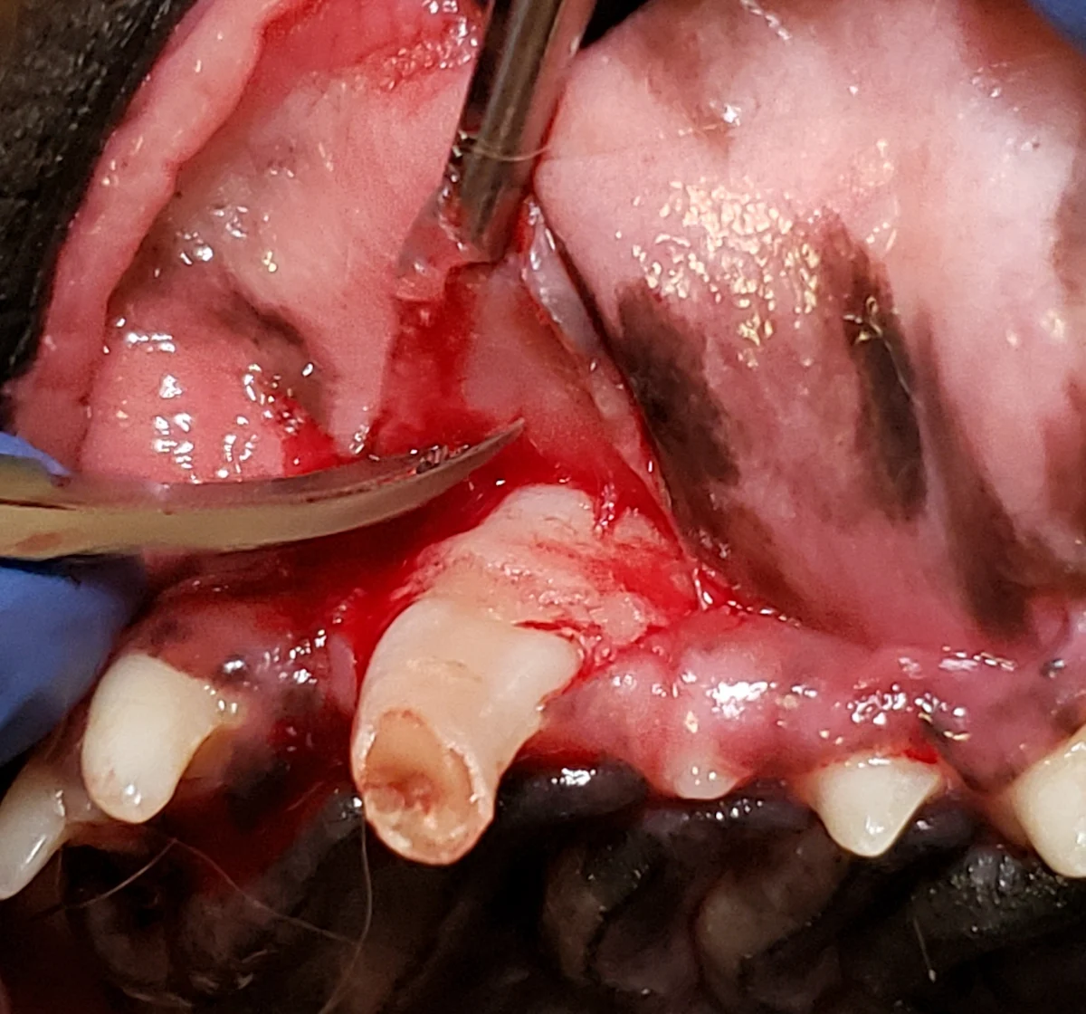 Forceps holding gingival flap away from canine tooth while scissors incise tissue on inner side of flap.