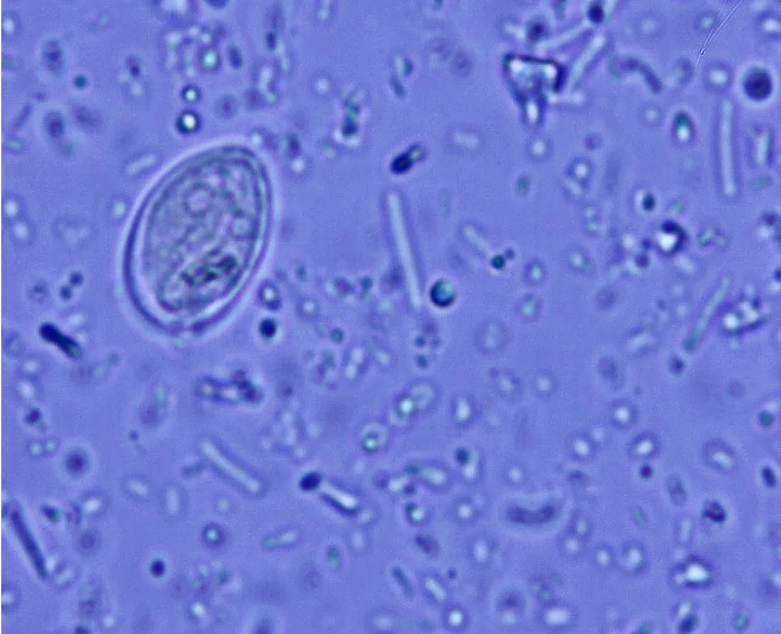 Slide showing a cyst.