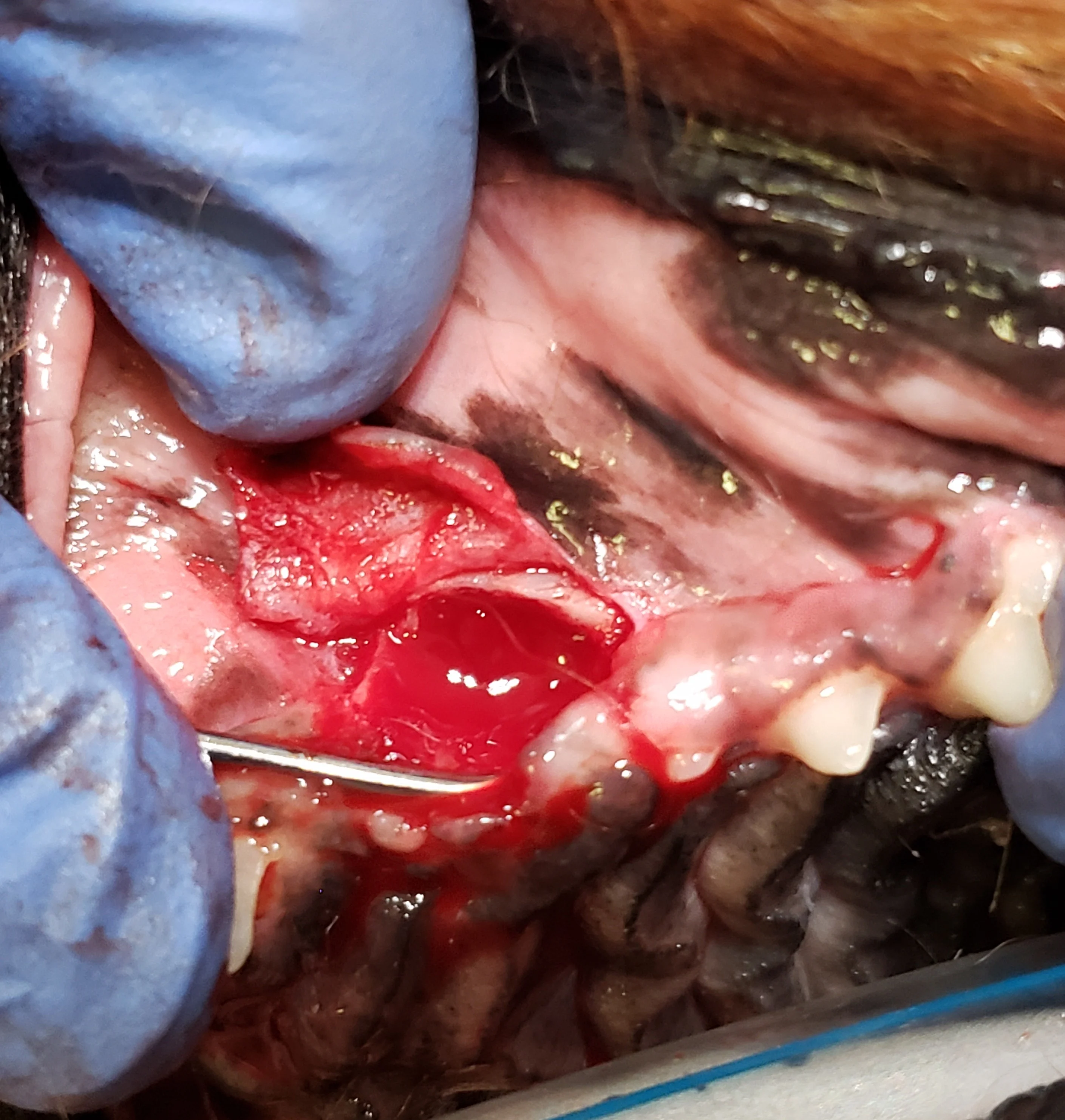 Gloved hands using periosteal elevator to lift palatal mucosa away from bone.