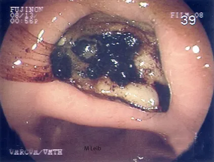 selected slide image