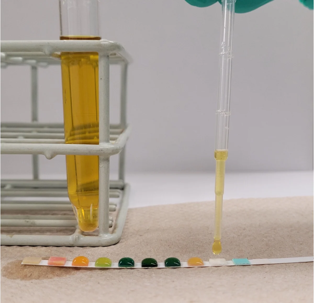 Urine being dropped onto pad of urine dipstick by gloved hand holding plastic pipette.