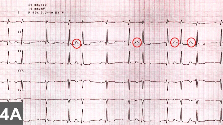selected slide image