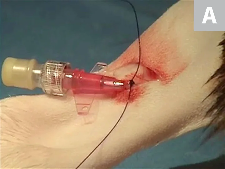 Three images demonstrating securing of catheter to skin and finished catheter placement on bandaged leg.