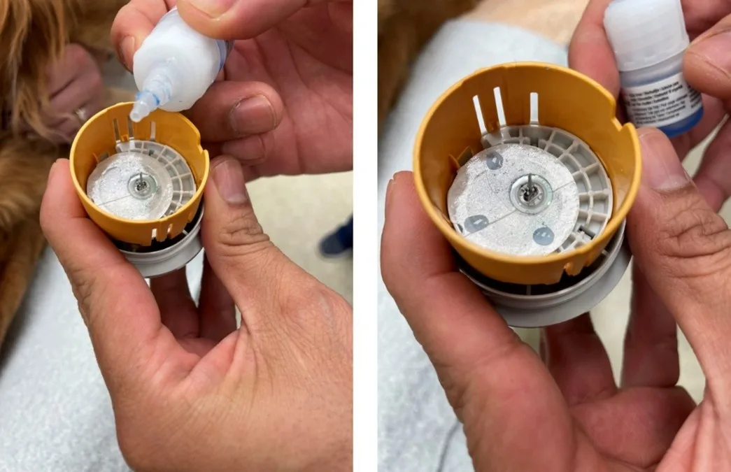 Hands holding open continuous blood glucose monitor as tissue glue is applied to monitor.