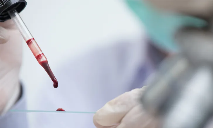 blood in a dropper over a glass slide