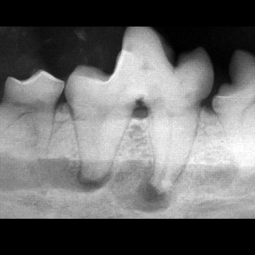How to Interpret Dental Radiographs Clinician's Brief