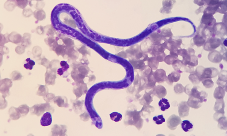 Doxycycline and outlet heartworms