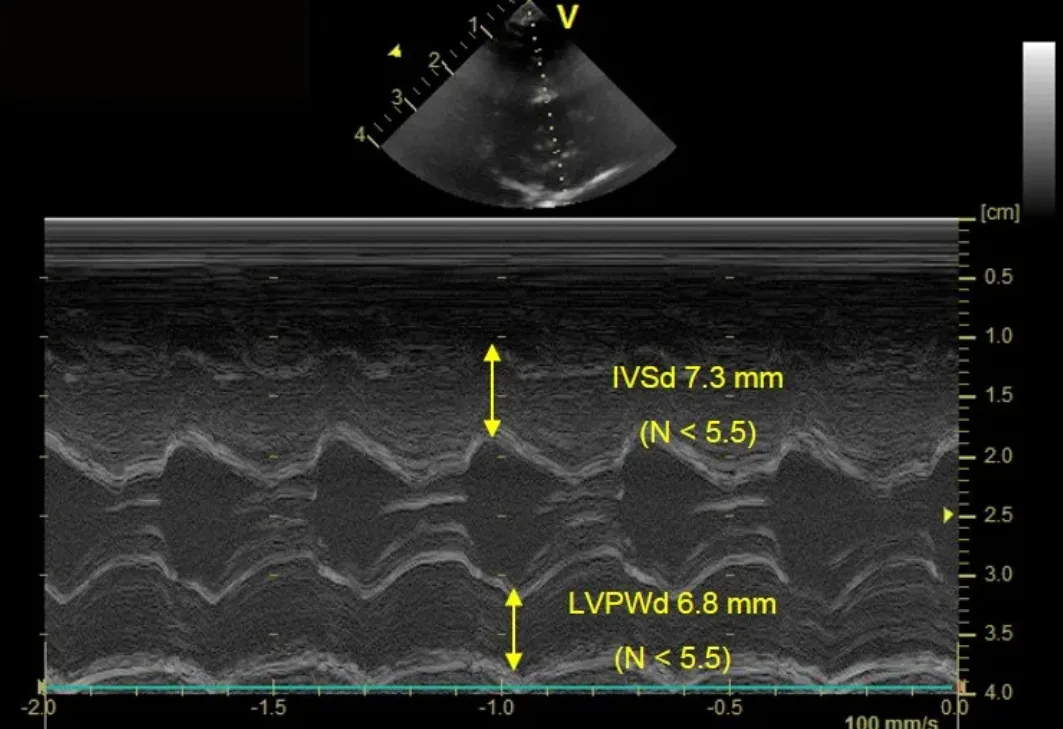 M-mode echocardiogram showing measurements for cardiac wall thickness and chamber dimension in cat with stage B2 HCM.