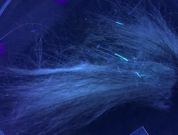 Animal hair on a dark background lit by a Wood’s lamp with fluorescent hairs present consistent with M. canis infection.