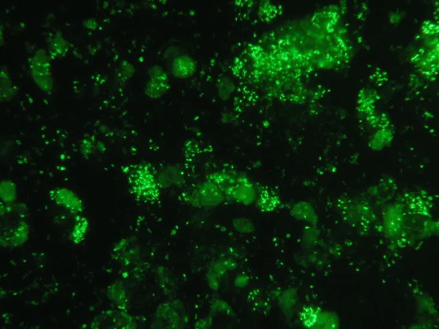 Immunofluorescent antibody serologic assay of B vinsonii subspecies berkhoffii.
