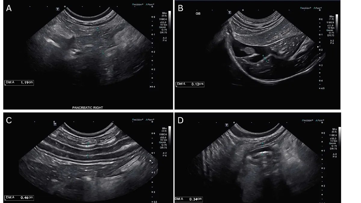 Four ultrasonographic images showing abnormal findings in the pancreas, gallbladder, and intestinal wall of a cat.