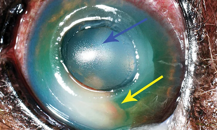 Eye with arrows showing circular complete ulceration of cornea and thick yellowish material at base of ventral anterior chamber.