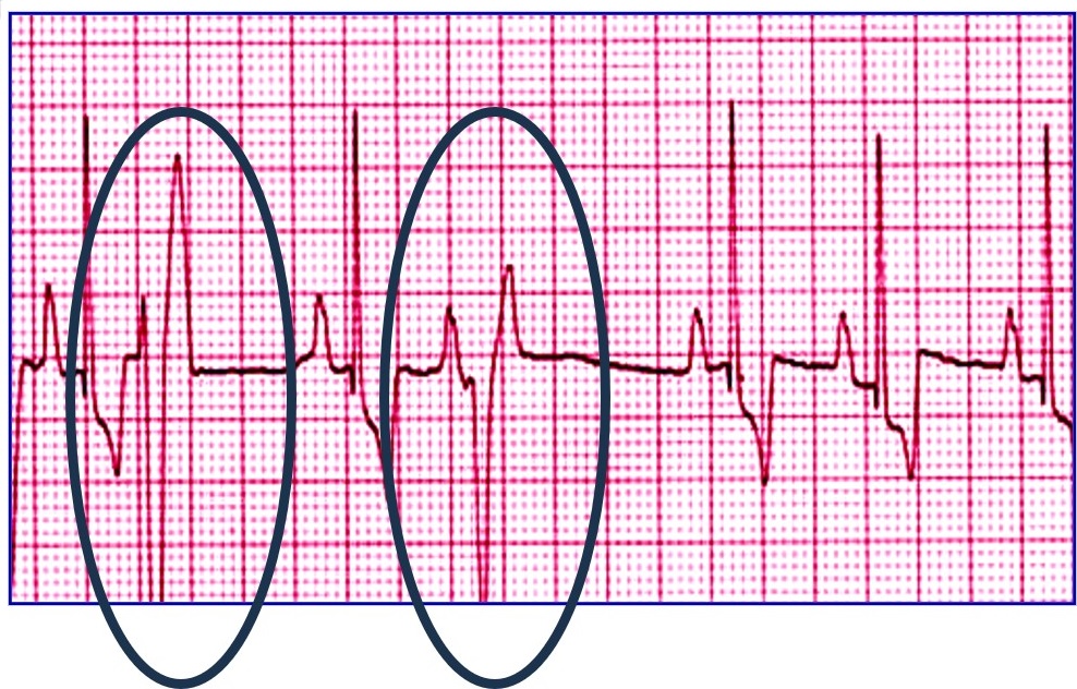 洋書 CARDIAC ARRHYTHMIAS in Dogs and Cats Amazon.com: Cardiac Arrhythmias in Dogs and Cats: Mechanisms