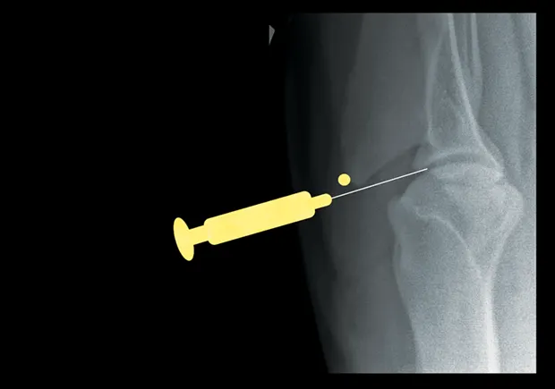Craniocaudal radiograph of a canine shoulder showing a needle in the space between the acromion and the humeral head.