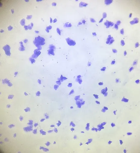 Vaginal cytology slide showing numerous angled cells, most with no nucleus.