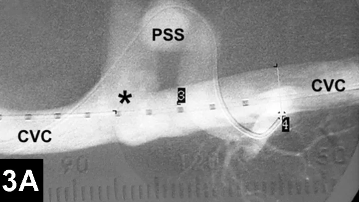 selected slide image