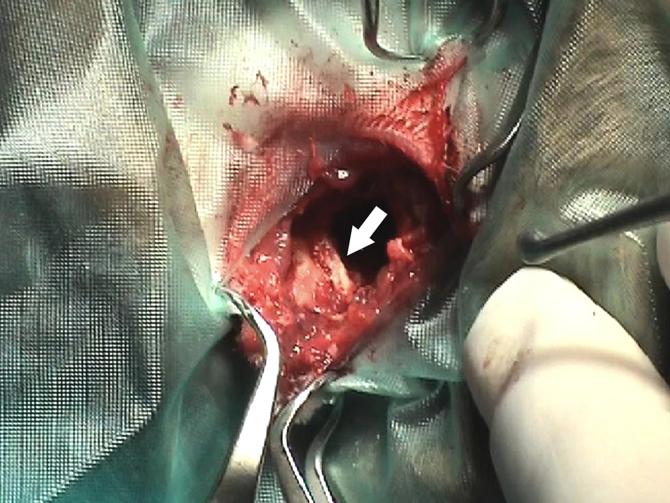 How to Treat Periapical Mandibular Abscess in Rabbits