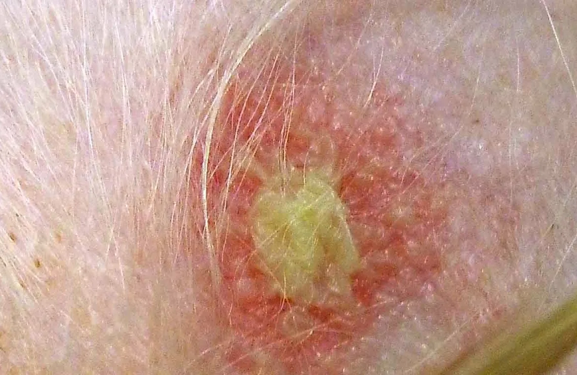 Close-up of a red, alopecic, circular lesion with a central, yellow-green crust on the skin of a dog.