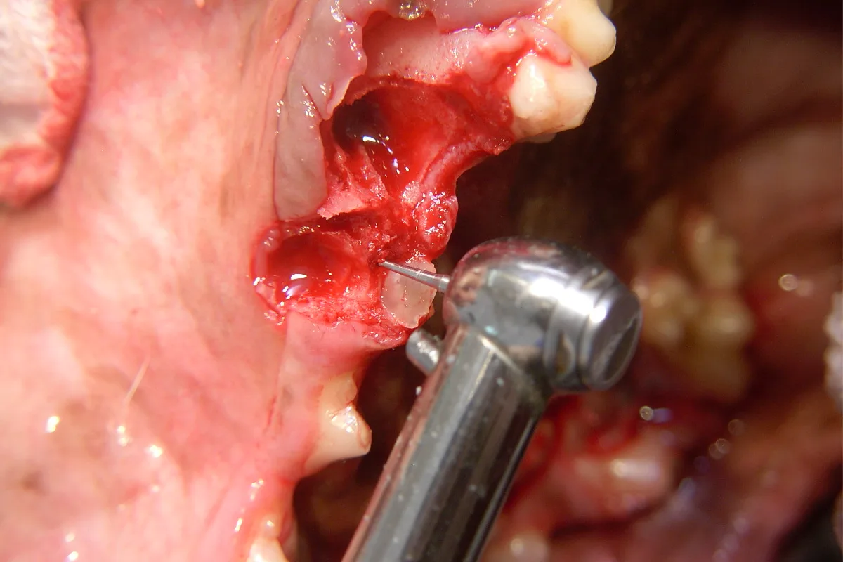 selected slide image