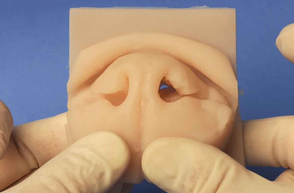 Silicone model of a dog's nose after the left alar fold has been removed.