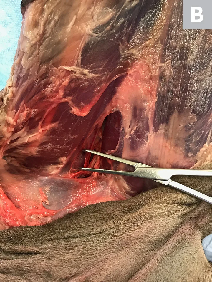 Images of medial aspect of pelvic limb after dissection with arrows pointing to vasculature in femoral triangle.