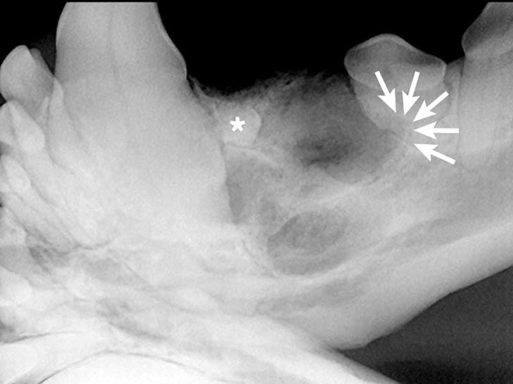 Multiple Oral Pathologies in a Dog Clinician's Brief