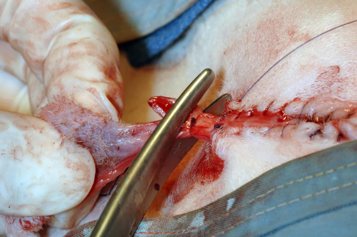 The penile body is amputated with surgical scissors.
