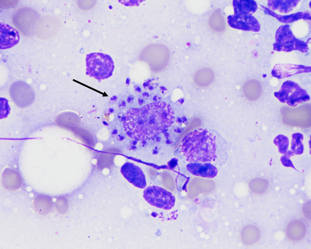 Arrow pointing to multiple small, round organisms with dark-purple–stained nuclei located within the cytoplasm of a macrophage.