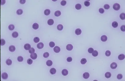 Cytology of RBCs with some containing small, dark-staining organisms.