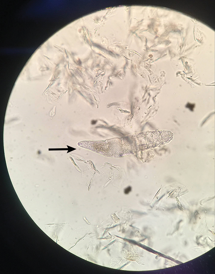 Demodicosis & Secondary Bacterial Folliculitis In A Dog | Clinician's Brief