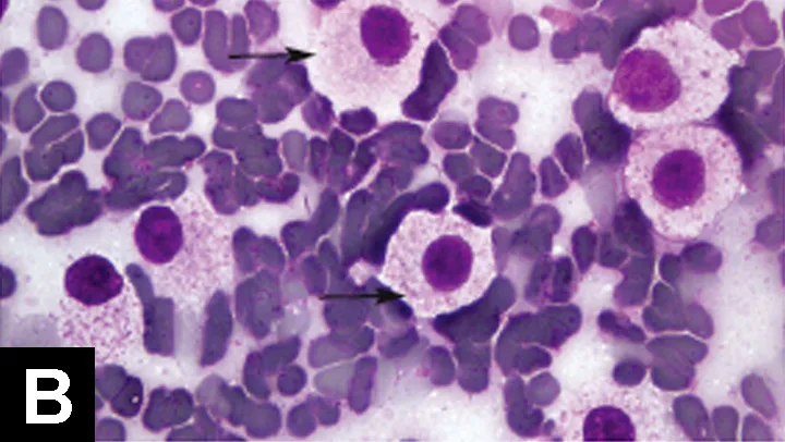 Stained cytology slide with arrows pointing to several mast cells.