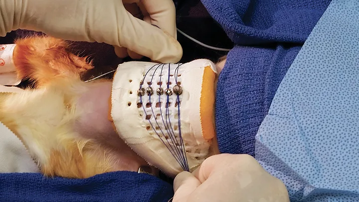 Sutures and split shot weights in place over external brace, with sutures being pulled laterally.