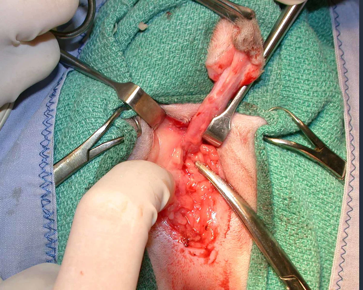 A: Intraoperative photo showing the ventral penile ligament. B: Intraoperative photo showing transection of the ventral penile ligament with surgical scissors.