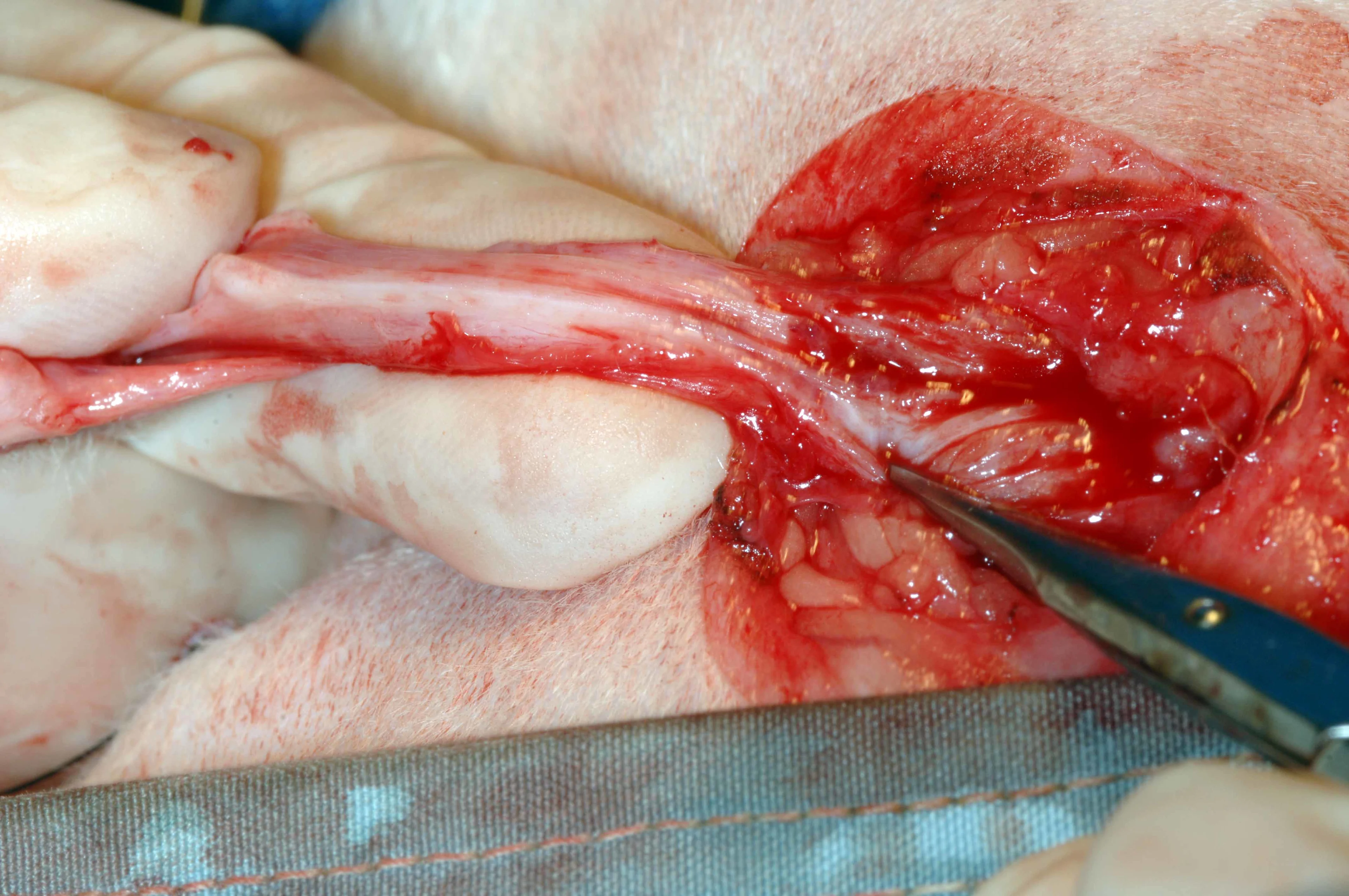A: Intraoperative photo showing exposure of the urethral mucosa.  B: A surgeon is placing simple interrupted sutures between the skin and urethral mucosa.  C: Hemostats are used to separate the dorsal and ventral urethral mucosa during suturing