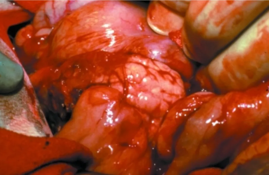 Intraoperative image of the pancreas.