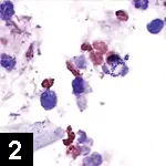 Recurrent Pruritus & Zoonotic Potential
