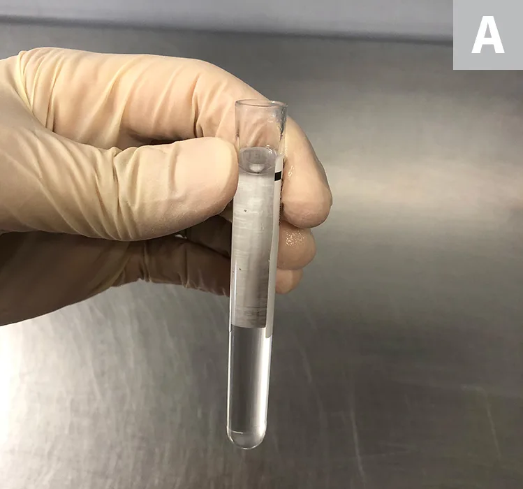 A hand holding a test tube to demonstrate the Rivalta test. 