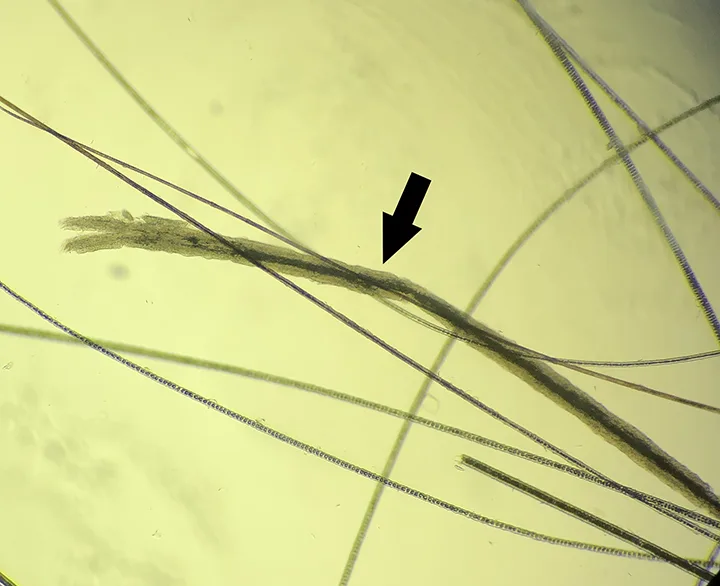 Several magnified hair shafts including one that with black pigment that is wider than other.