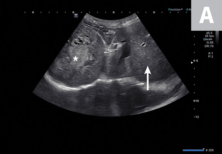 Top 5 Ultrasound Scenarios in General Practice Clinician's Brief